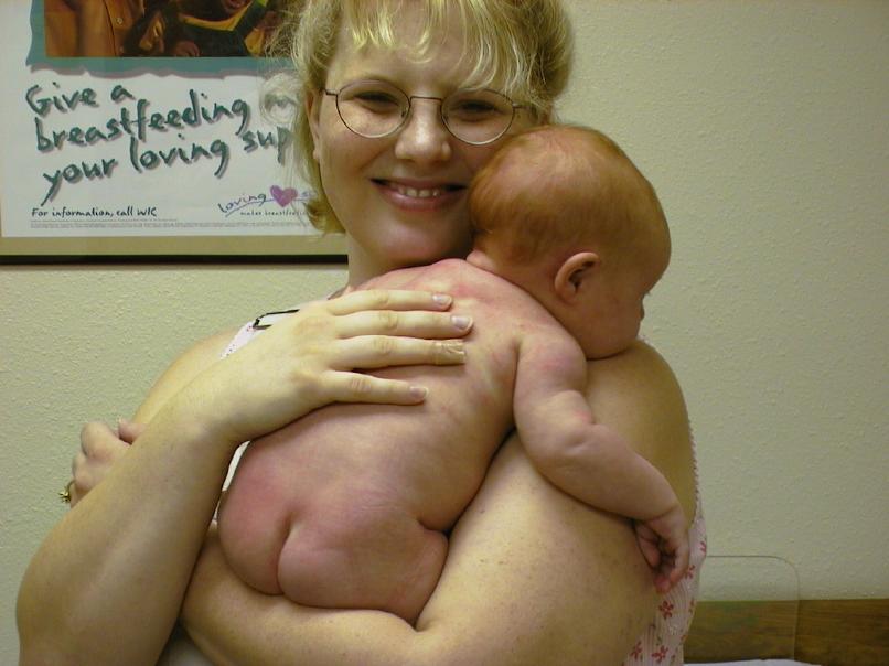 Sweet Cheeks
